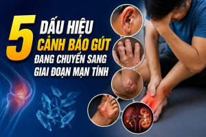 5 dấu hiệu cảnh báo gút đang chuyển sang giai đoạn mạn tính