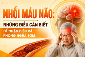 Nhồi máu não: Những điều cần biết để nhận diện và phòng ngừa sớm