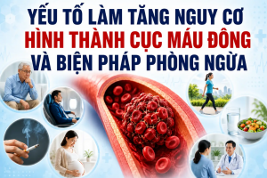 Yếu tố làm tăng nguy cơ hình thành cục máu đông và biện pháp phòng ngừa