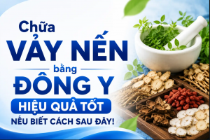 Chữa vảy nến bằng đông y: Những điều cần biết để đạt hiệu quả tốt