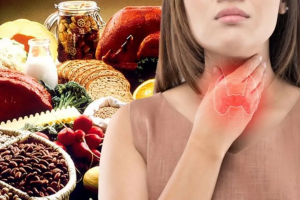 Chế độ dinh dưỡng người bướu tuyến giáp cần lưu tâm