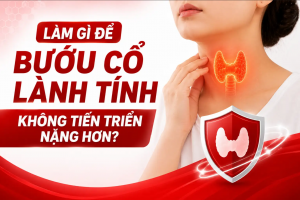 Làm gì để bướu cổ lành tính không tiến triển nặng hơn?