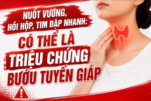 Nuốt vướng, tim đập nhanh: Chớ coi thường "tiếng kêu cứu" từ tuyến giáp