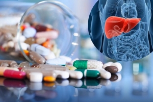 Cảnh báo gia tăng tổn thương gan do lạm dụng vitamin và thực phẩm chức năng