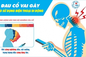 Cảnh báo các vấn đề xương khớp và thị lực do thói quen sử dụng điện thoại sai tư thế