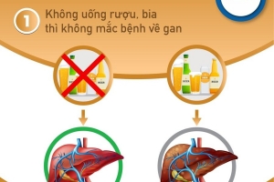 Chuyên gia y tế cảnh báo những ngộ nhận tai hại về sản phẩm giải độc gan và cách bảo vệ sức khỏe chuyển hóa