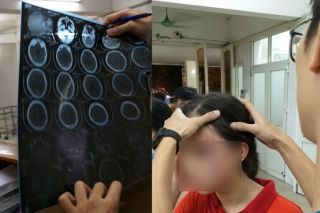 Hà Nội: Con gái 14 tuổi cầu cứu mẹ đẻ vì bị mẹ kế đánh rạn đầu