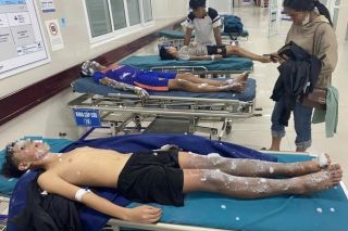 Quảng Bình: Bốn học sinh nhập viện do tai nạn chế pháo nổ