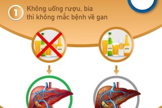 Chuyên gia y tế cảnh báo những ngộ nhận tai hại về sản phẩm giải độc gan và cách bảo vệ sức khỏe chuyển hóa