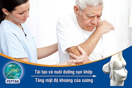 3 bệnh cần cẩn trọng khi giảm đau xương khớp