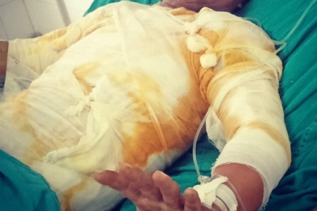 Điện lực Hà Tĩnh: Đình chỉ công tác 8 người trong vụ phóng điện gây bỏng nặng