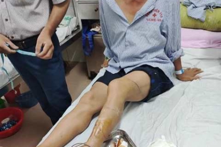 Hà Tĩnh: Sẽ xử lý nghiêm 3 cha con hành hung, chém đứt gân chân công an xã