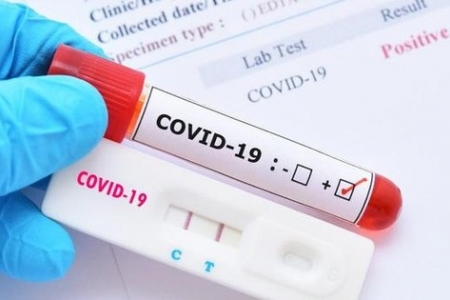 Phú Thọ: Khuyến khích người dân tự xét nghiệm SARS-CoV-2 bằng test nhanh kháng nguyên