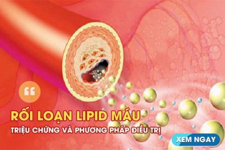 Rối loạn lipid máu – Triệu chứng và phương pháp điều trị