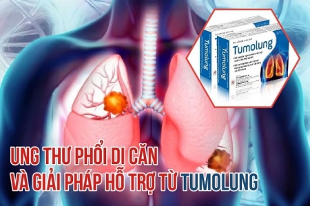 Thông tin về ung thư phổi di căn và giải pháp hỗ trợ từ Tumolung