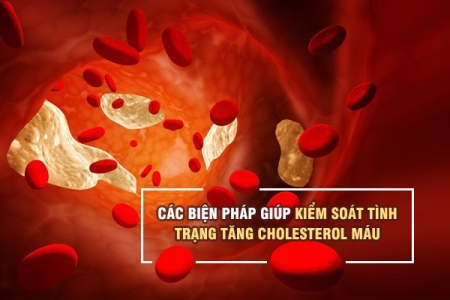 Các biện pháp giúp kiểm soát tình trạng tăng cholesterol máu