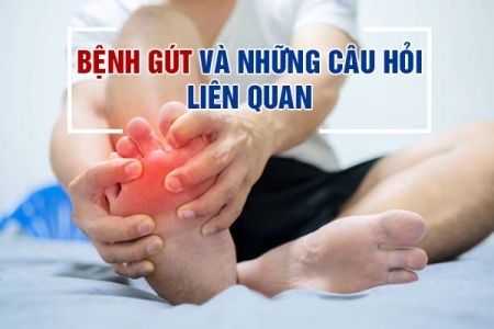 Bệnh gút và những câu hỏi liên quan mà bạn cần phải biết