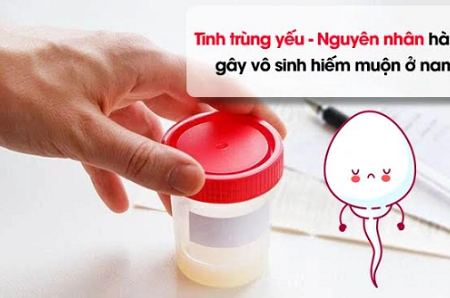 Tinh trùng yếu - Nguyên nhân gây vô sinh hiếm muộn ở nam giới