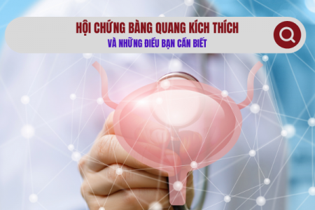 Hội chứng bàng quang kích thích và những điều bạn cần biết