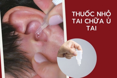 Các thuốc nhỏ tai khi bị ù tai thường dùng và lưu ý khi sử dụng