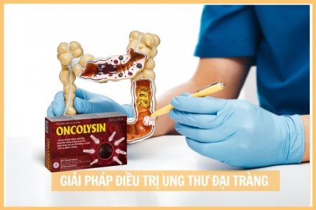 Oncolysin - Giải pháp thảo dược hỗ trợ điều trị ung thư đại tràng