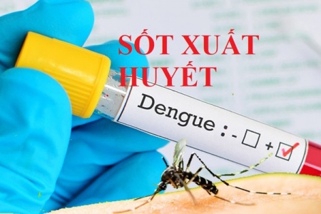 Hà Nội ghi nhận 2 ca tử vong do sốt xuất huyết, Bộ Y tế cho nhập 17.010 túi truyền Dextran