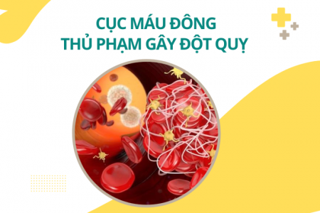 Cục máu đông: Thủ phạm gây đột quỵ và cách làm tan từ Nattospes