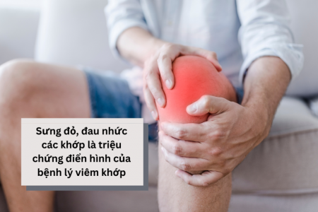 Triệu chứng cảnh báo bệnh viêm khớp và giải pháp từ Hoàng Thấp Linh