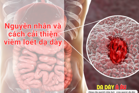 Loét dạ dày: nguyên nhân và cách cải thiện từ Dạ Dày Á Âu