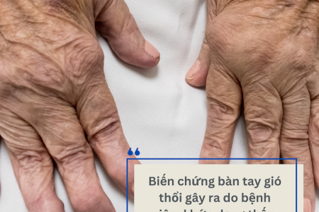 Bàn tay gió thổi: Dấu hiệu và giải pháp phòng ngừa từ Hoàng Thấp Linh