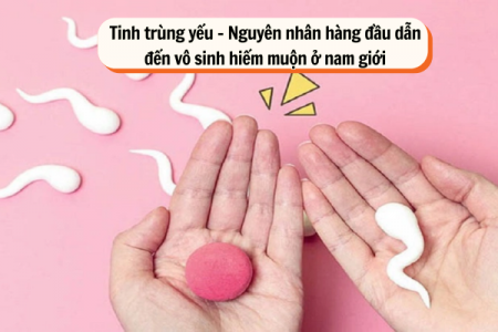 Tinh trùng yếu - Nguyên nhân hàng đầu dẫn đến vô sinh hiếm muộn ở nam giới