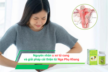 Nguyên nhân u xơ tử cung và giải pháp cải thiện từ Nga Phụ Khang