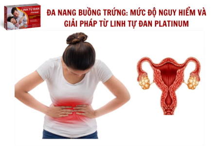 Đa nang buồng trứng: mức độ nguy hiểm và giải pháp từ Linh Tự Đan Platinum