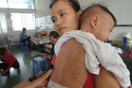 Nhiều trẻ chưa được tiêm chủng vaccine đúng lịch, đủ mũi, do ảnh hưởng của đại dịch Covid-19