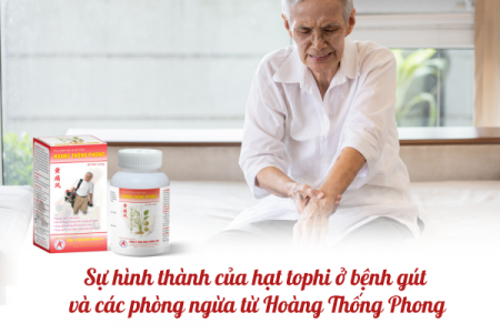 Sự hình thành hạt tophi ở người bệnh gút và cách phòng ngừa từ Hoàng Thống Phong