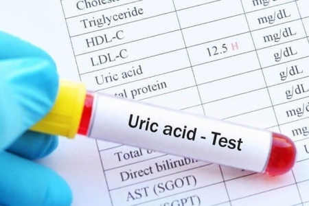Nguyên nhân gây tăng axit uric máu và cách khắc phục từ Hoàng Thống Phong