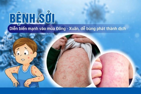 Rà soát, không bỏ sót các trường hợp đủ điều kiện tiêm chủng nhưng chưa được tiêm đầy đủ vắc xin phòng bệnh sởi