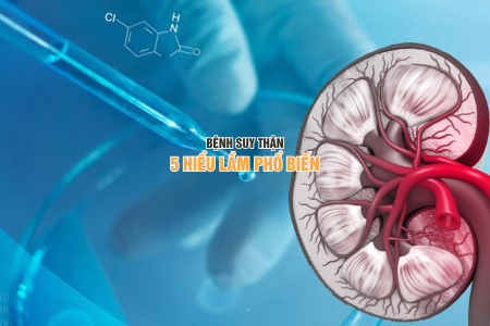 Bệnh suy thận - 5 hiểu lầm phổ biến