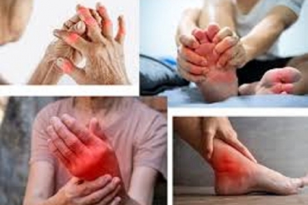 Axit Uric cao: "Kẻ thù thầm lặng" gây gút và sỏi thận, làm sao để kiểm soát tự nhiên?