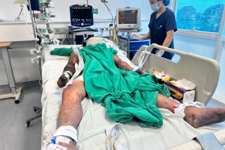 Hà Nội ghi nhận 1 người tử vong do mắc liên cầu lợn đầu tiên trong năm