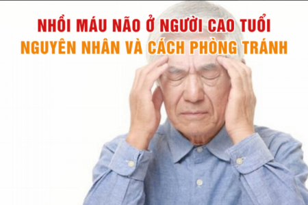 Nhồi máu não ở người cao tuổi: Nguyên nhân và cách phòng tránh