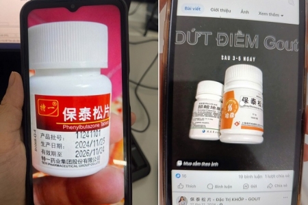 Bộ Y tế cảnh báo về Phenylbutazone: Nhiều ca dị ứng nặng, thậm chí tử vong do dùng thuốc không rõ nguồn gốc