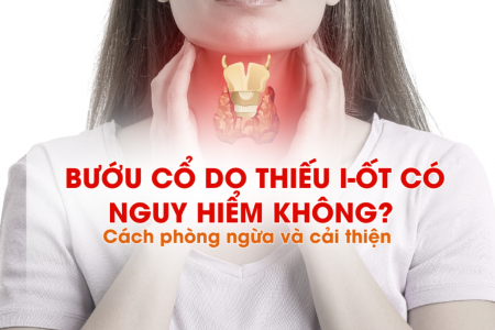 Bướu cổ do thiếu i-ốt có nguy hiểm không? Cách phòng ngừa và cải thiện