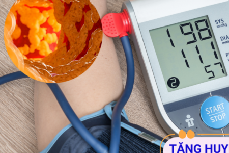 Làm thế nào để cải thiện tăng huyết áp kèm mỡ máu cao?
