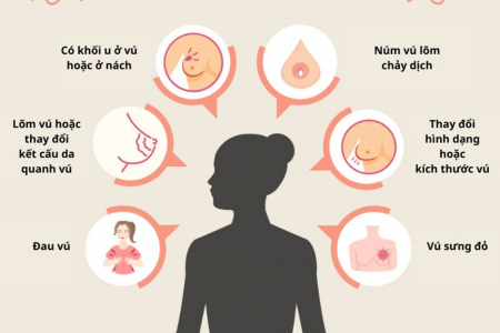 Không chỉ là khối u: 5 dấu hiệu sớm của ung thư vú dễ bị nhầm lẫn và bỏ qua