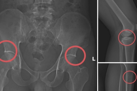Phú Thọ siết chặt kỷ cương sau vụ đường dây trục lợi bảo hiểm bị triệt phá