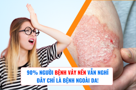 90% người bệnh vảy nến vẫn nghĩ đây chỉ là bệnh ngoài da!