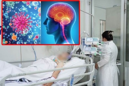 Cảnh báo sự trở lại của bệnh não mô cầu xâm lấn với nguy cơ tử vong nhanh trong 24 giờ