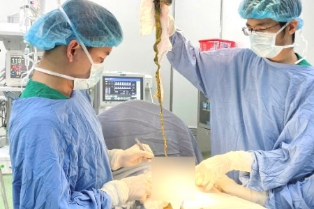 Bệnh viện Phụ sản - Nhi Đà Nẵng: Phẩu thuật một ca do trẻ em ăn tóc, hiếm gặp trong y khoa