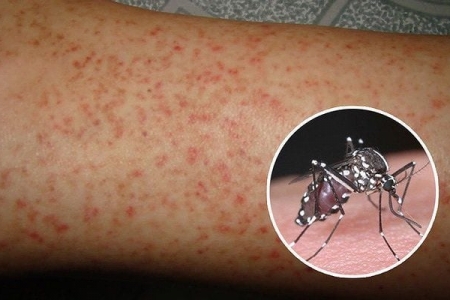 Tăng cường diệt lăng quăng, bọ gậy để phòng, chống sốt xuất huyết dịp cận Tết